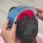 Φωτοδυναμική θεραπεία